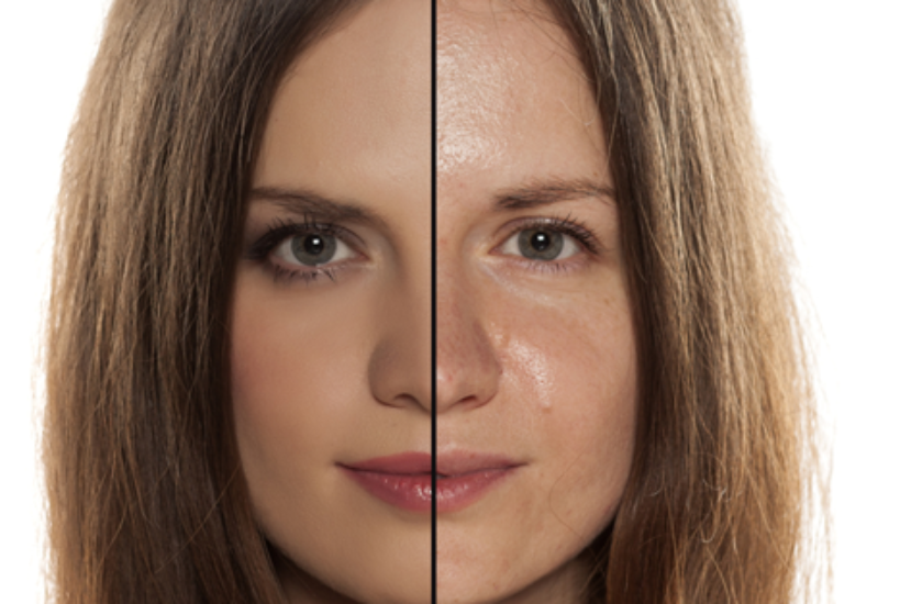 Yağlı Ciltler Nasıl Kontrol Edilir? 10 Altın Kural!