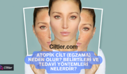 Atopik Cilt (Egzama) Neden Olur? Belirtileri ve Tedavi Yöntemleri Nelerdir?