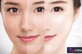 Yüzümün Rengini Nasıl Açabilirim? Evde Doğal Yöntemler?