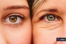 Evde Kırışıklık Tedavisi