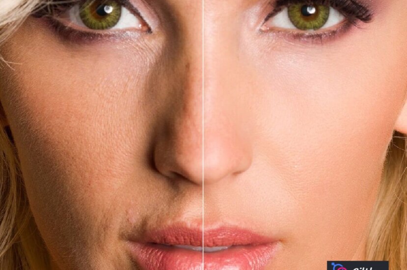 Yüzümüzün Pürüzsüz Olması İçin Ne Yapmalıyız