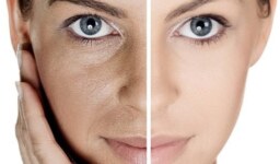 Beyaz Cilt Nasıl Olur? Cildinizi Aydınlatmanın Yolları