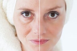 Cilt Bakımından Sonra Yapılması Gerekenler: Güzellik Sırlarını Keşfedin!