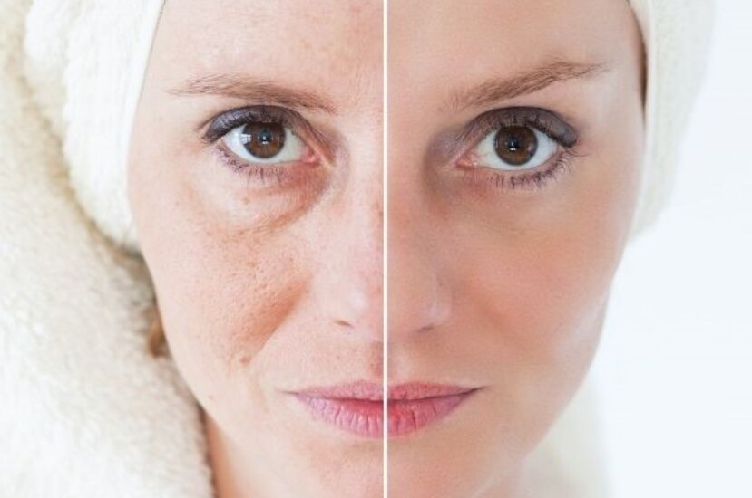 Cilt Bakımından Sonra Yapılması Gerekenler: Güzellik Sırlarını Keşfedin!