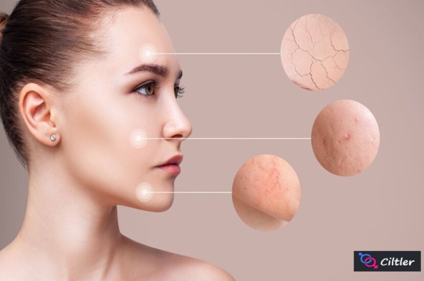 Cilt Kuruluğuna Ne iyi Gelir?