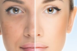 Doğal Yöntemlerle Lekelerden Arınma: Doğadan Gelen Güç