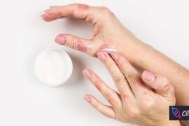 Doğanın Şifalı Gücü: Egzamaya Bitkisel Çözüm