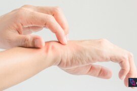 El Üstünde Kızarıklık ve Kabarmanın 6 Olası Nedeni: Cilt Sağlığınızı Koruyun!