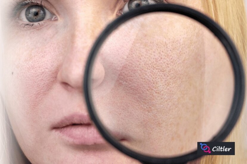 Gözenek Temizleyici Maskeler