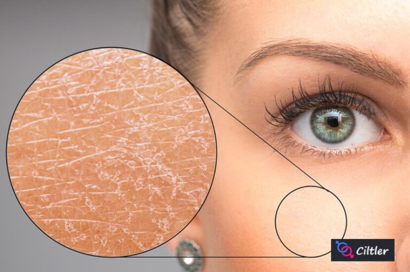 Kuru Ciltlerin Kurtarıcısı: Günlük Cilt Bakım Rutinleri ile Parlak Bir Cilde Kavuşun