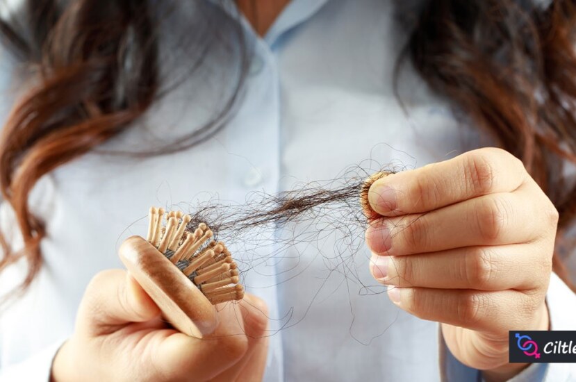 Saç Dökülmesi Hangi Vitamin Eksikliği