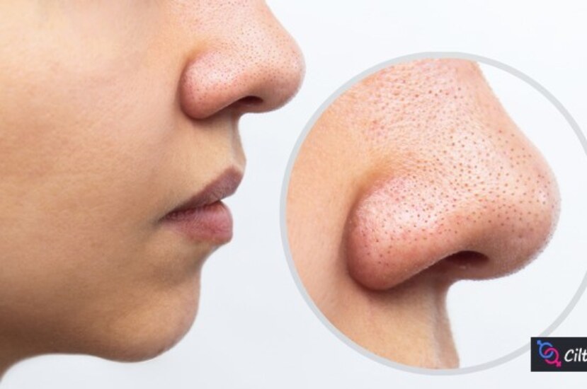 Yüzdeki Noktalar İçin Maske: Güzelliğinizi Artıracak Doğal Çözümler