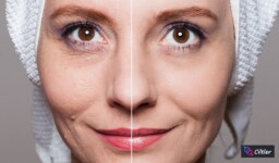 Cilt Gençleştirme Uygulamaları: Gençliğin Sırları