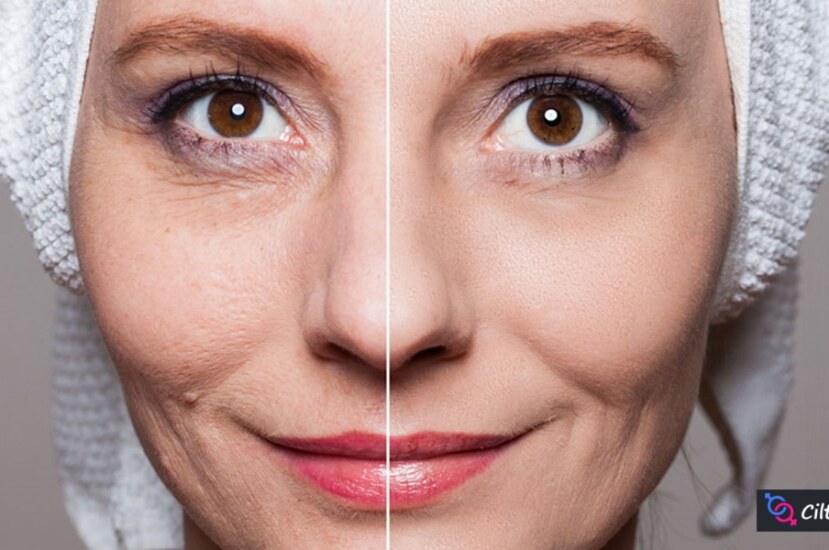 Cilt Gençleştirme Uygulamaları: Gençliğin Sırları