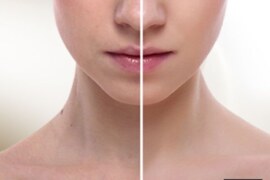 Gözenek Temizleme Maskesi Tarifleri: Pürüzsüz Bir Cilt İçin Doğal Çözümler