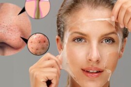 Doğal Siyah Nokta Maskesi: En Etkili 5 Yöntem!